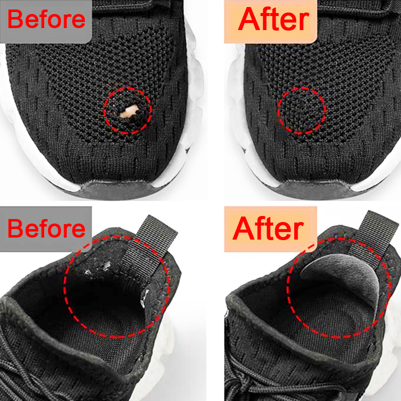 Sports Shoes Patches Vamp Repa - Sneaker Care Accessories ulasan dan harga